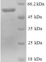 Human DDB1- and CUL4-associated factor 7 (DCAF7) Recombinant Protein - BioCrest Sci