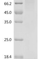 Human Eukaryotic elongation factor 2 kinase (EEF2K) Recombinant Protein - BioCrest Sci
