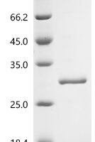 Rat Myosin regulatory light polypeptide 9 (Myl9)(X69Y) Recombinant Protein - BioCrest Sci