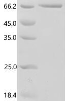 Mouse Endothelin-1 (Edn1), partial Recombinant Protein, N-HSA/C-10His - BioCrest Sci