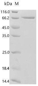 Mouse Endothelin-1 (Edn1), partial Recombinant Protein, N-HSA/C-10His, Mus musculus (Mouse), Mammalian cell, N-terminal HSA-tagged and C-terminal 10xHis-tagged, 70.6 kDa, purity >≥ 95% as determined by SDS-PAGE.
