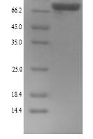 Mouse Lysyl oxidase homolog 4 (Loxl4) Recombinant Protein, N-His, aa 26–757, Yeast - BioCrest Sci