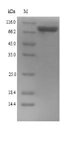 Mouse Lysyl oxidase homolog 4 (Loxl4) Recombinant Protein, N-His, aa 26–757, Yeast, Mus musculus (Mouse), Yeast, N-terminal 6xHis-tagged, 83.9 kDa, purity >≥ 90% as determined by SDS-PAGE.