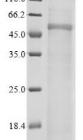Human Wiskott-Aldrich syndrome protein (WAS) Recombinant Protein - BioCrest Sci