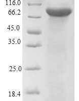 Human Dopamine beta-hydroxylase (DBH), partial Recombinant Protein, N-His, aa 40–617, E.coli - BioCrest Sci