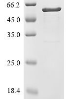 Mouse Troponin T, cardiac muscle (Tnnt2) Recombinant Protein - BioCrest Sci