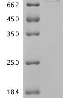 Human ATP-dependent RNA helicase DDX3X (DDX3X) Recombinant Protein, C-10His - BioCrest Sci