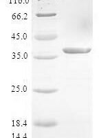 Human Protein S100-A3 (S100A3) Recombinant Protein - BioCrest Sci