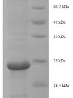 Centruroides suffusus Beta-mammal toxin Css4 Recombinant Protein, N-His-SUMO - BioCrest Sci