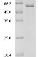 Human Transforming growth factor beta regulator 1 (TBRG1) Recombinant Protein, C-His, aa 1–411, E.coli - BioCrest Sci