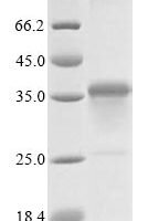 Plasmodium falciparum Erythrocyte-binding antigen 175, partial Recombinant Protein - BioCrest Sci