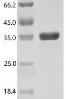 Human Carbonic anhydrase 12 (CA12), partial Recombinant Protein - BioCrest Sci