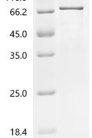 Human DNA-binding protein Ikaros (IKZF1) Recombinant Protein - BioCrest Sci