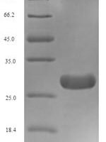 Xenopus laevis Transforming growth factor beta-1 (tgfb1) Recombinant Protein - BioCrest Sci