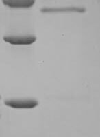 Human Sodium/calcium exchanger 1 (SLC8A1), partial Recombinant Protein - BioCrest Sci