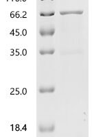 Mouse Angiopoietin-related protein 2 (Angptl2) Recombinant Protein, C-His - BioCrest Sci