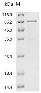 Mouse Angiopoietin-related protein 2 (Angptl2) Recombinant Protein, C-His, Mus musculus (Mouse), E.coli, C-terminal 6xHis-tagged, 61.9 kDa, purity >≥ 85% as determined by SDS-PAGE.