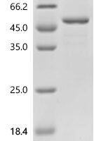 Xenopus laevis Chitinase domain-containing protein 1 (chid1) Recombinant Protein - BioCrest Sci