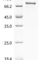 Human Serine/threonine-protein phosphatase 2A regulatory subunit B'' subunit beta (PPP2R3B) Recombinant Protein, C-His - BioCrest Sci
