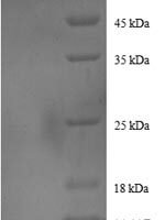 Human DnaJ homolog subfamily B member 1 (DNAJB1) Recombinant Protein - BioCrest Sci