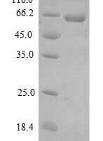 Dog Uncharacterized protein (DMP1) Recombinant Protein - BioCrest Sci
