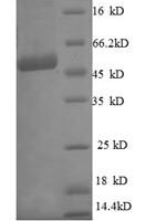 Human ES1 protein homolog, mitochondrial (C21orf33) Recombinant Protein - BioCrest Sci