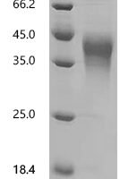 Human Hepatitis A virus cellular receptor 2 (HAVCR2), partial Recombinant Protein, C-10His - BioCrest Sci