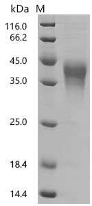 Human Hepatitis A virus cellular receptor 2 (HAVCR2), partial Recombinant Protein, C-10His, Homo sapiens (Human), Mammalian cell, C-terminal 10xHis-tagged, 21.2 kDa, purity >≥ 95% as determined by SDS-PAGE.