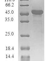 Human Synaptogyrin-1 (SYNGR1) Recombinant Protein - BioCrest Sci