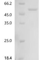 Rat Tripartite motif-containing protein 72 (Trim72) Recombinant Protein, C-10His - BioCrest Sci