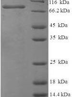 Chicken Vitellogenin-1 (VTG1), partial Recombinant Protein - BioCrest Sci