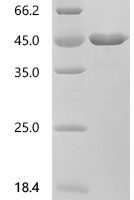 Human Anaphase-promoting complex subunit 5 (ANAPC5), partial Recombinant Protein, C-His - BioCrest Sci