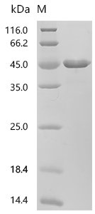 Human Anaphase-promoting complex subunit 5 (ANAPC5), partial Recombinant Protein, C-His, Homo sapiens (Human), E.coli, C-terminal 6xHis-tagged, 45.9 kDa, purity >≥ 95% as determined by SDS-PAGE.≥ 95% as determined by SEC-HPLC.