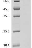 Human BTB/POZ domain-containing protein KCTD21 (KCTD21) Recombinant Protein, C-10His-HSA - BioCrest Sci