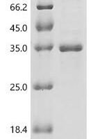 Human Gamma-aminobutyric acid receptor subunit alpha-2 (GABRA2), partial Recombinant Protein - BioCrest Sci