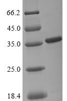 Dengue virus 2 Genome polyprotein (T2493G,G2494S,I2762T), partial Recombinant Protein - BioCrest Sci
