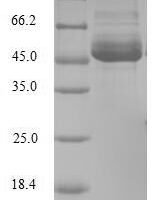 Human Bcl-2-modifying factor (BMF) Recombinant Protein, N-GST - BioCrest Sci