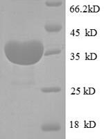 Human Cystatin-B (CSTB) Recombinant Protein - BioCrest Sci
