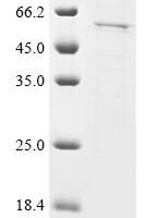 Human Islet cell autoantigen 1 (ICA1) Recombinant Protein, C-His - BioCrest Sci