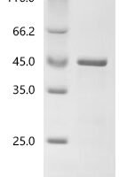 Mycobacterium tuberculosis PPE family immunogenic protein PPE68 (PPE68) Recombinant Protein - BioCrest Sci