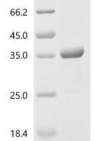 Human Prohibitin-2 (PHB2), partial Recombinant Protein, N-10His/C-Myc - BioCrest Sci
