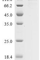Human Sterol regulatory element-binding protein 1 (SREBF1), partial, Biotinylated Recombinant Protein - BioCrest Sci