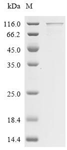 Human Sterol regulatory element-binding protein 1 (SREBF1), partial, Biotinylated Recombinant Protein, Homo sapiens (Human), E.coli, N-terminal MBP-tagged and C-terminal 6xHis-Avi-tagged, 98.0 kDa, purity >≥ 85% as determined by SDS-PAGE.
