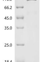Mouse Heat shock protein HSP 90-beta (Hsp90ab1) Recombinant Protein, N-10His/C-Myc - BioCrest Sci