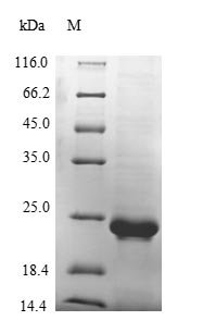 Mouse von Willebrand factor (Vwf), partial Recombinant Protein, N-10His/C-Myc, Mus musculus (Mouse), E.coli, N-terminal 10xHis-tagged and C-terminal Myc-tagged, 23.9 kDa, purity >≥ 85% as determined by SDS-PAGE.