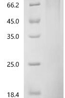 Mouse Interleukin-3 (Il3) Recombinant Protein, C-10His - BioCrest Sci