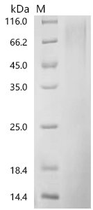 Mouse Interleukin-3 (Il3) Recombinant Protein, C-10His, Mus musculus (Mouse), Yeast, C-terminal 10xHis-tagged, 17.7 kDa, purity >≥ 90% as determined by SDS-PAGE.