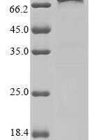 Human Three-prime repair exonuclease 1 (TREX1) Recombinant Protein, N-10His-MBP/C-His - BioCrest Sci