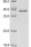 Human Galectin-9 (LGALS9) Recombinant Protein, C-His - BioCrest Sci