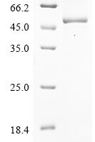 Human Ubl carboxyl-terminal hydrolase 18 (USP18) Recombinant Protein, N-10His/C-Myc - BioCrest Sci